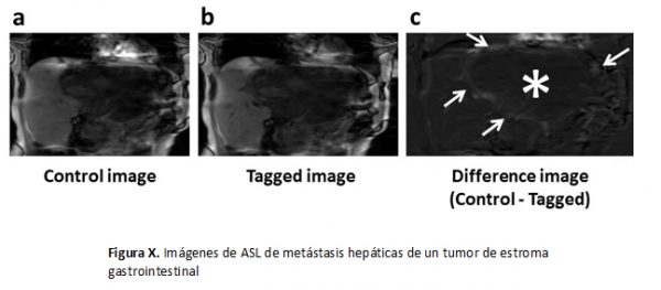 Investigación clínica y desarrollo de la resonancia magnética funcional