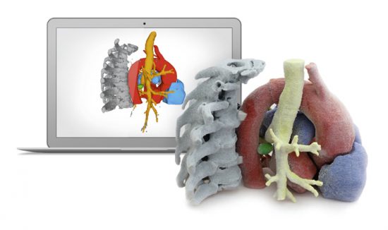 HT médica - Programa i+d+i - Impresión 3D