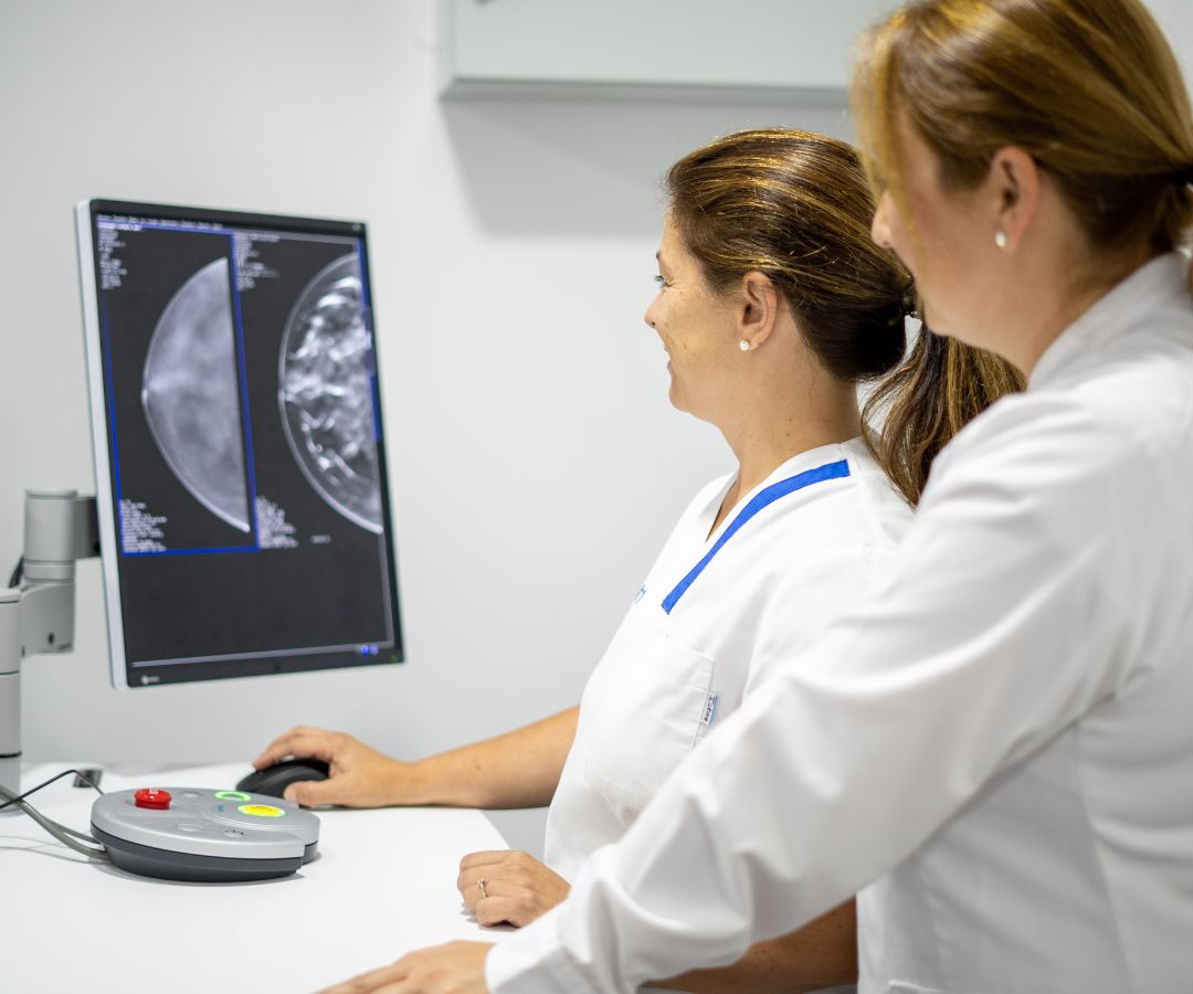 HT-Médica-Marbella-mamografía 3D