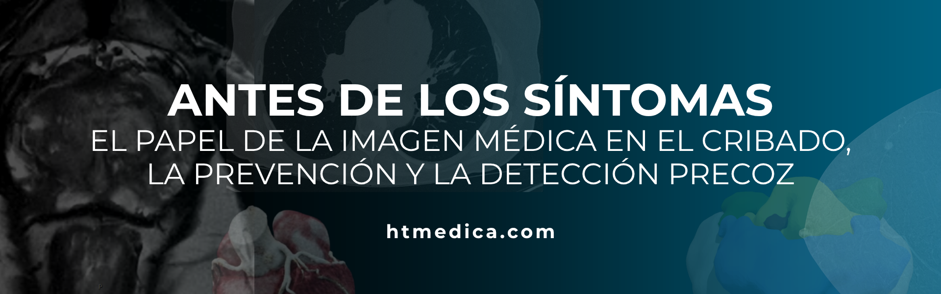 Antes de los síntomas: el papel de la imagen médica en el cribado, la prevención y la detección precoz