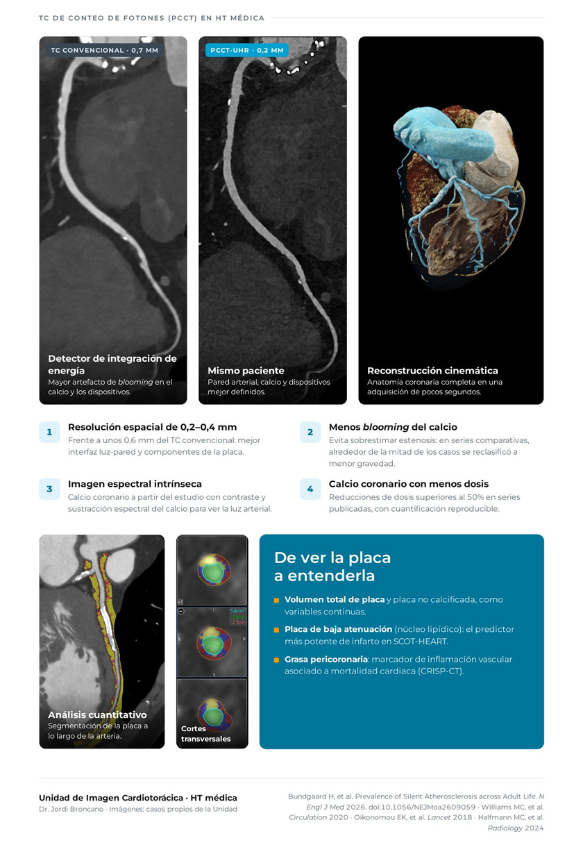 Infografía cardiovascular: aterosclerosis silenciosa y TC de conteo de fotones en HT Médica