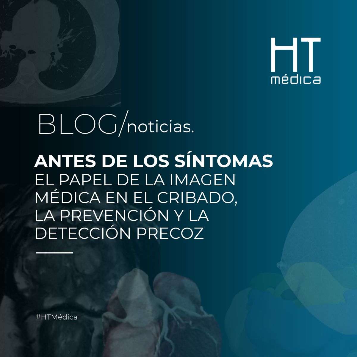 Antes de los síntomas · Blog y noticias de HT Médica