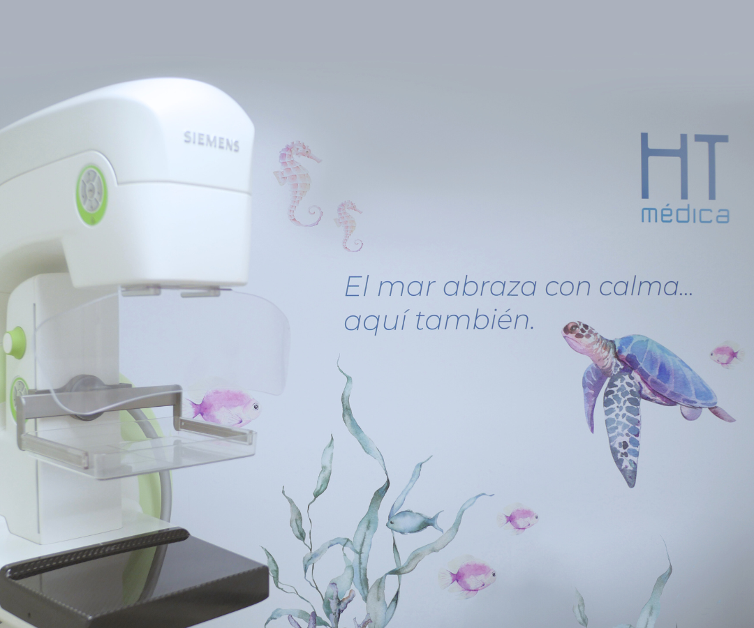 mammography-marbella-htmedica